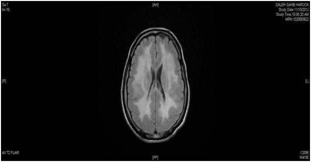 thymidine2