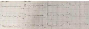 DX-ICD-1