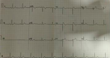 DX-ICD-2