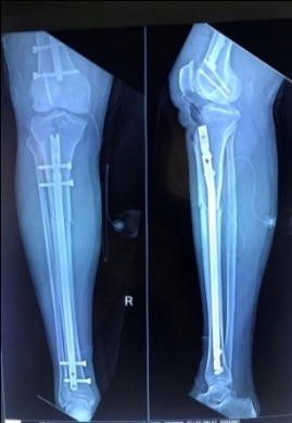 orthopaedics-case-series-14