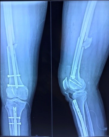 orthopaedics-case-series-15