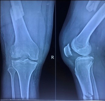 orthopaedics-case-series-16