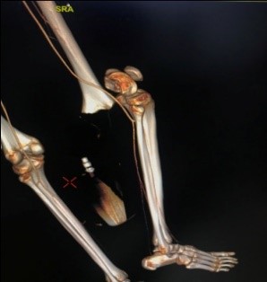 orthopaedics-case-series-3