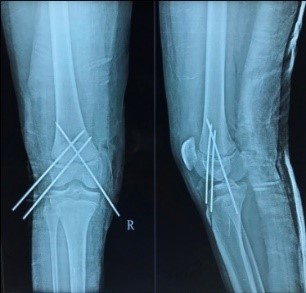 orthopaedics-case-series-5