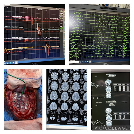 challenges-in-neuroanaesthesia-and-neurointensive-care-3