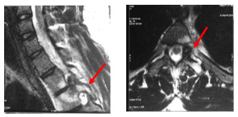 Minimally-invasive-surgery-1