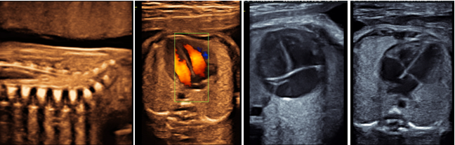 Foetal-Medicine-3