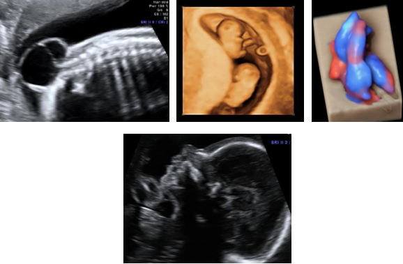 Foetal-Medicine-4