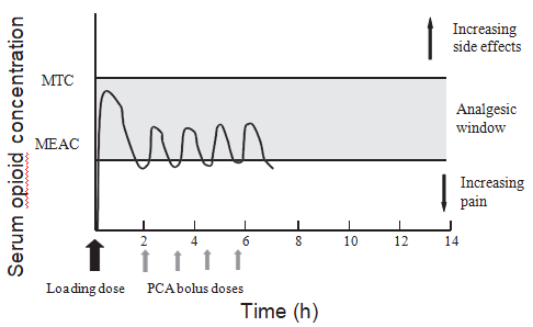 Patient-Controlled-Analgesia-1