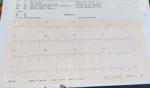 Hyperkalemia-2