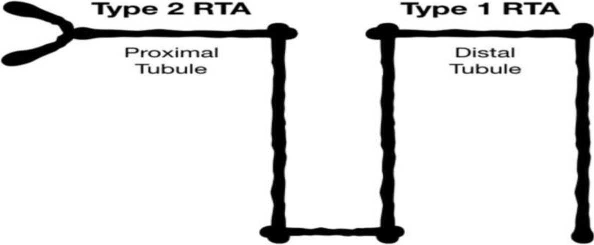 Hypokalemic4