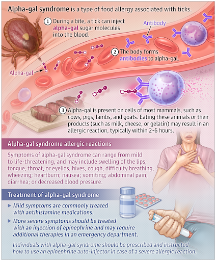 Lymphoma-7