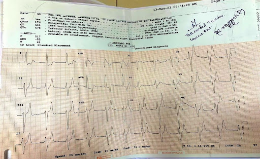 Hyperkalemia-1