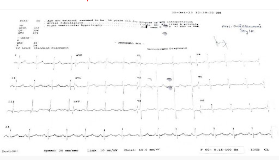 ECG-0