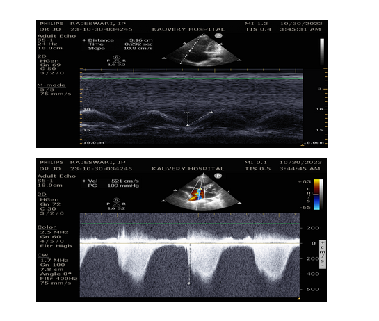 ECG-2