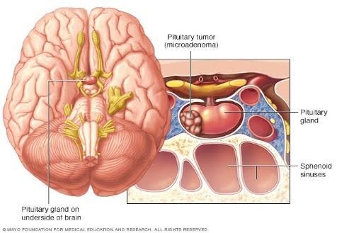 Endocrine-1