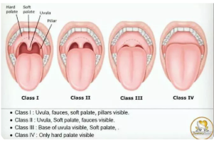 anaesthetic2