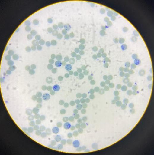 Manual-reticulocyte-preparation