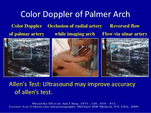 dopler-of-palmer-march