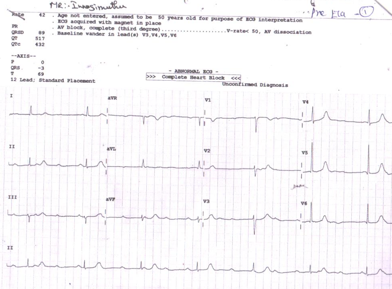 Pre-ECG