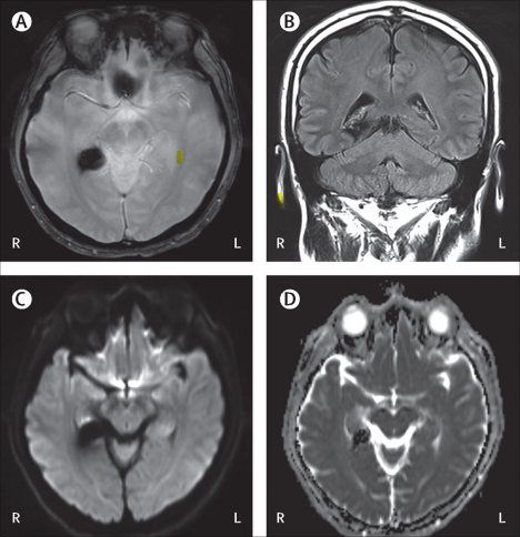 mri-scan