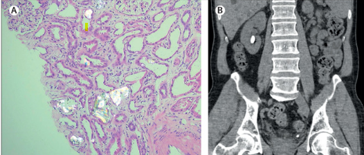 nephrology 