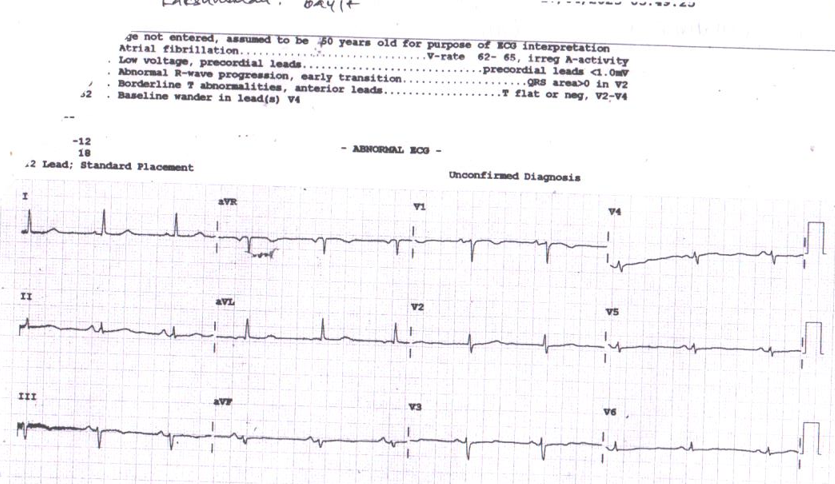 several-sinus-node-12