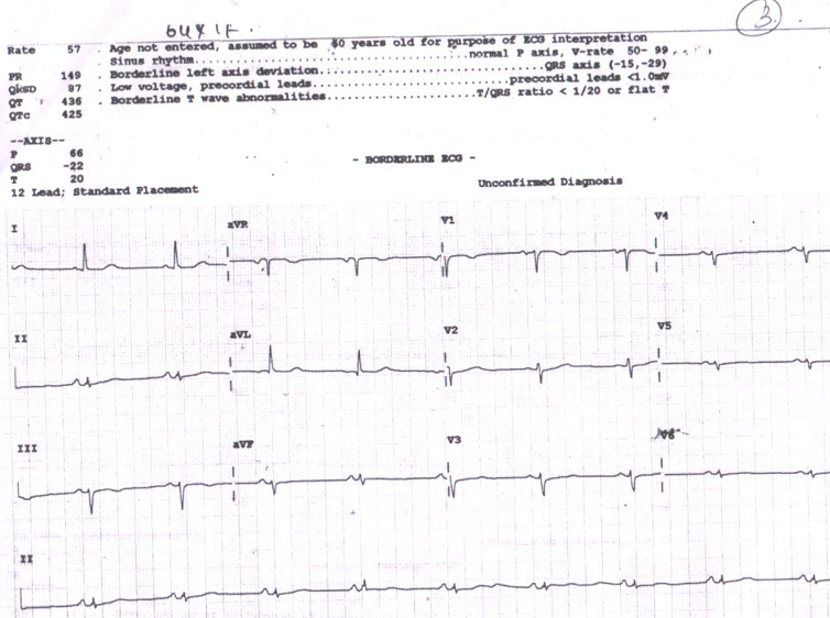 several-sinus-node-3