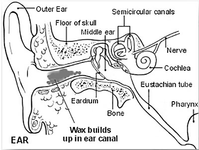ear-wax