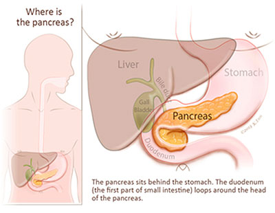 pancreatitis