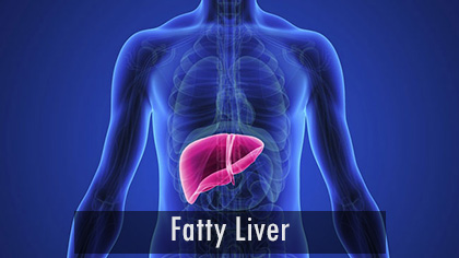 fatty_liver