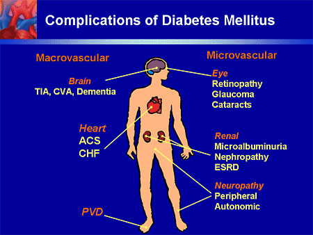 diabetes-mellitus-and-neurology-2