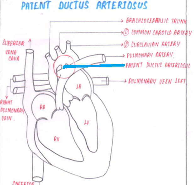 patent3