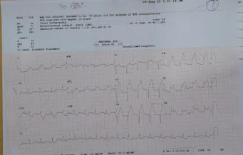 Nursing-Care-of-Patient-with-Myocardial-Infarction-1