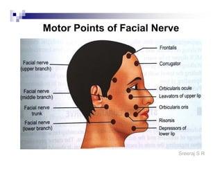 ELECTRICAL MUSCLE STIMULATION IN BELL'S PALSY