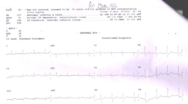 ECG-2