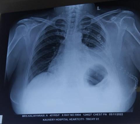 post-operative-x-ray