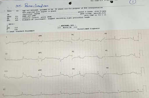 Coronary-Angiography-2