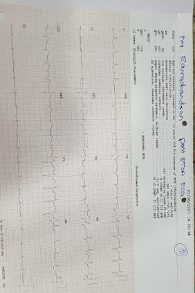 Coronary-Angiography-3