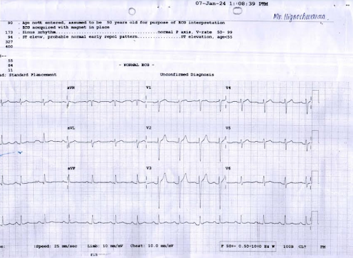 ECG-Report-1