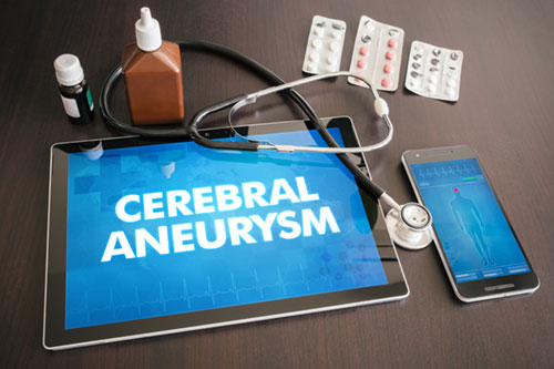 understanding aneurysm