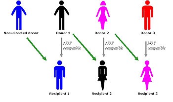 Swap Kidney Transplantation