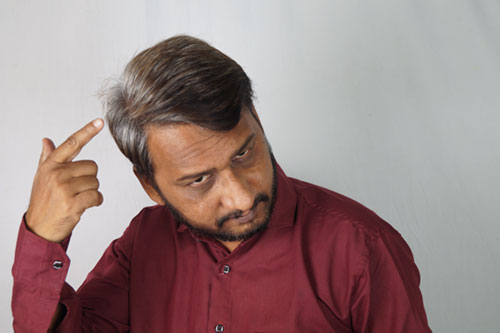 Premature Greying of Hair